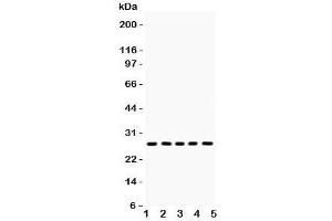 Image no. 2 for anti-Hydroxysteroid (17-Beta) Dehydrogenase 10 (HSD17B10) (AA 48-261) antibody (ABIN3031271)