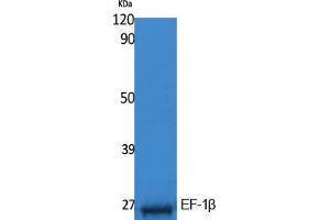 Image no. 1 for anti-Eukaryotic Translation Elongation Factor 1 beta 2 (EEF1B2) (Internal Region) antibody (ABIN3187598)