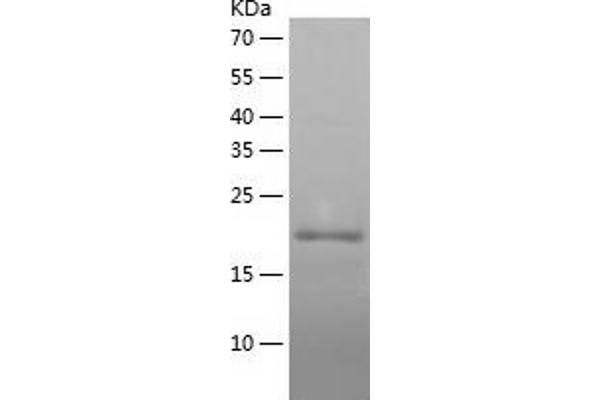 LSM12B Protein (AA 1-195) (His tag)