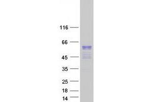 Image no. 1 for ERG, ETS transcription factor (ERG) (Transcript Variant 2) protein (Myc-DYKDDDDK Tag) (ABIN2720465)
