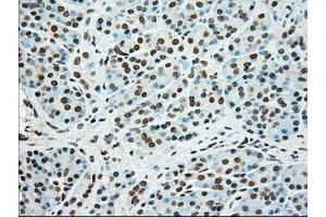 Image no. 3 for anti-Sjogren Syndrome Antigen B (SSB) antibody (ABIN1501146)