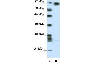 Image no. 1 for anti-Myoneurin (MYNN) (Middle Region) antibody (ABIN1108362)