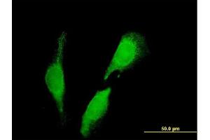 Immunofluorescence of purified MaxPab antibody to SEC23IP on HeLa cell.