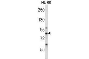 Image no. 2 for anti-Calpain 6 (CAPN6) (AA 289-319), (Middle Region) antibody (ABIN951010)