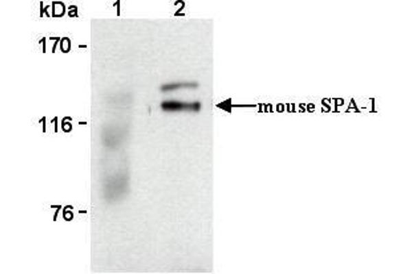 SIPA1 anticorps