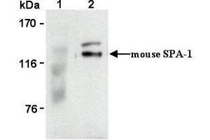 Image no. 1 for anti-Signal-Induced Proliferation-Associated 1 (SIPA1) antibody (ABIN1449260)