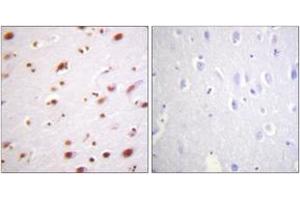 Immunohistochemistry analysis of paraffin-embedded human brain, using Catenin-delta1 (Phospho-Tyr228) Antibody.