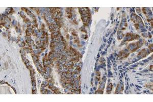 Image no. 1 for anti-Neutrophil Cytosolic Factor 4, 40kDa (NCF4) (pThr154) antibody (ABIN6256483)