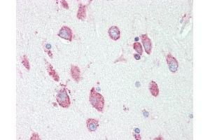 Image no. 2 for anti-Hexosaminidase A (HEXA) (AA 142-170) antibody (ABIN1901794)