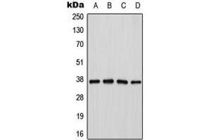 Image no. 2 for anti-Cathepsin H (CTSH) (Center) antibody (ABIN2705706)