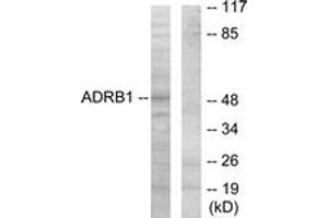 Image no. 1 for anti-Adrenergic, beta-1-, Receptor (ADRB1) (AA 281-330) antibody (ABIN1534260)