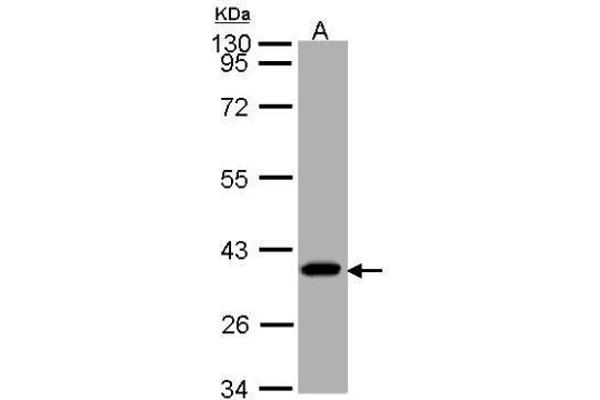 SUCLG1 抗体  (full length)