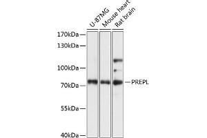 PREPL Antikörper  (AA 578-727)