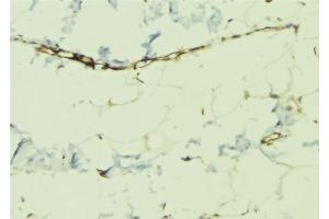 Image no. 3 for anti-erythrocyte Membrane Protein Band 4.9 (Dematin) (EPB49) (pSer403) antibody (ABIN6255309)