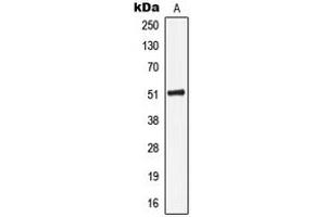 Image no. 1 for anti-Keratin 16 (KRT16) (C-Term) antibody (ABIN2704702)