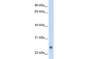 Image no. 1 for anti-Fast Skeletal Troponin I (TNNI2) (N-Term) antibody (ABIN2784492)