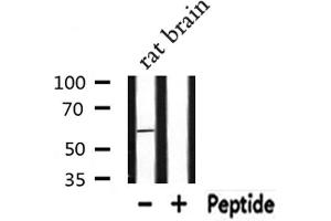 RAB11FIP2 抗体  (Internal Region)
