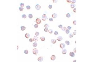 Image no. 3 for anti-Maelstrom Spermatogenic Transposon Silencer (MAEL) (C-Term) antibody (ABIN6657327)