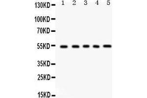 Image no. 1 for anti-Vitronectin (VTN) (AA 446-472), (C-Term) antibody (ABIN3042327)
