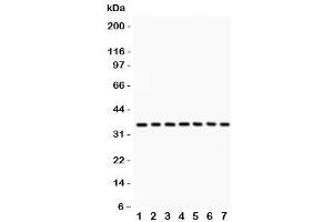 Image no. 5 for anti-Protein Phosphatase 2A Activator, Regulatory Subunit 4 (PPP2R4) (AA 1-309) antibody (ABIN3032389)
