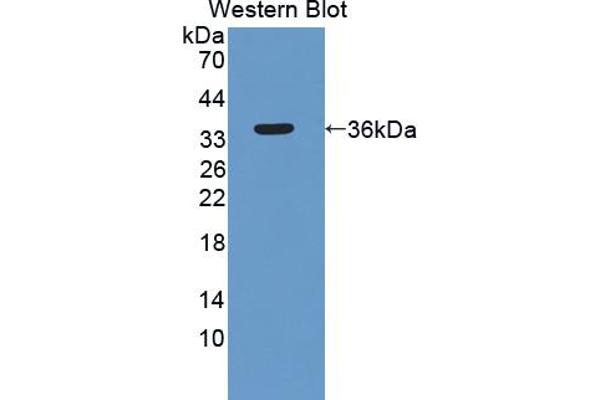 anti-Spectrin Repeat Containing, Nuclear Envelope 1 (SYNE1) (AA 30-283) antibody