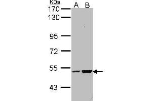 Image no. 1 for anti-EF-hand calcium binding domain 14 (EFCAB14) (Center) antibody (ABIN2855310)