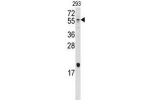 Image no. 1 for anti-Bone Morphogenetic Protein 10 (BMP10) (N-Term) antibody (ABIN357176)