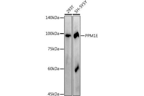 PPM1E Antikörper