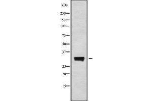 Image no. 1 for anti-Potassium Large Conductance Calcium-Activated Channel, Subfamily M beta Member 3 (KCNMB3) (N-Term) antibody (ABIN6262755)