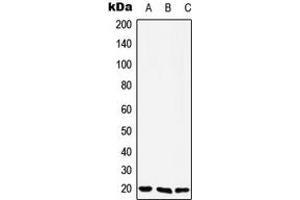 Image no. 1 for anti-YY1 Associated Factor 2 (YAF2) (N-Term) antibody (ABIN2707786)
