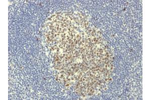 Image no. 3 for anti-B-Cell CLL/lymphoma 6 (BCL6) (AA 256-389) antibody (ABIN6940531)