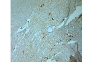 Tyrosine Hydroxylase antibody  (AA 30-100)