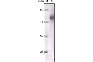Image no. 2 for anti-Keratin 1 (KRT1) (truncated) antibody (ABIN2464043)