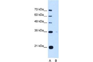 Image no. 1 for anti-Torsin Family 1, Member B (Torsin B) (TOR1B) (C-Term) antibody (ABIN2782816)