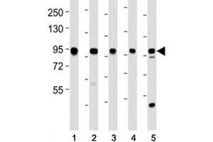 Image no. 7 for anti-Enhancer of Zeste Homolog 2 (EZH2) antibody (ABIN3028636)
