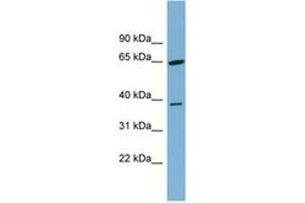 anti-Carbohydrate Kinase Domain Containing (Carkd) (AA 251-300) antibody
