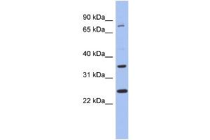 Image no. 1 for anti-Zinc Finger Protein 133 (ZNF133) (N-Term) antibody (ABIN2780518)