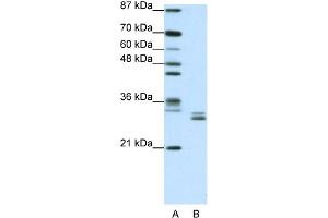 Image no. 1 for anti-Chloride Intracellular Channel 5 (CLIC5) (C-Term) antibody (ABIN2776220)