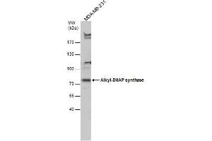 WB Image Alkyl-DHAP synthase antibody detects Alkyl-DHAP synthase protein by Western blot analysis.