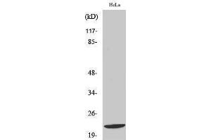 Image no. 1 for anti-DIRAS Family, GTP-Binding RAS-Like 1 (DIRAS1) (C-Term) antibody (ABIN3184311)