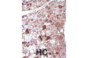 Image no. 2 for anti-phosphoenolpyruvate Carboxykinase 1 (Soluble) (PCK1) (AA 40-70), (N-Term) antibody (ABIN392676)