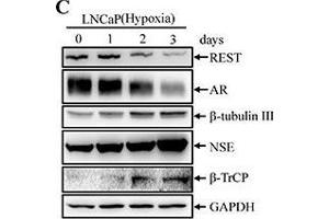 Image no. 109 for anti-Glyceraldehyde-3-Phosphate Dehydrogenase (GAPDH) (Center) antibody (ABIN2857072)