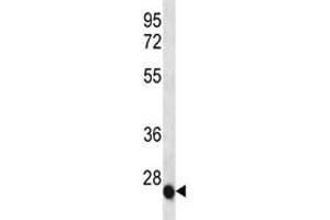 Image no. 4 for anti-Interleukin 6 (IL6) (AA 27-55) antibody (ABIN3031289)