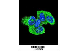 Image no. 1 for anti-HRas proto-oncogene, GTPase (HRAS) (AA 146-176), (C-Term) antibody (ABIN655622)