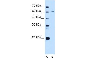 anti-Chromatin Licensing and DNA Replication Factor 1 (CDT1) (C-Term) antibody