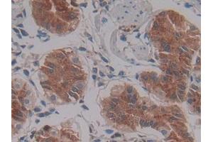 DAB staining on IHC-P; Samples: Human Stomach Tissue