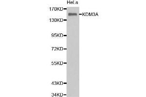Image no. 2 for anti-Lysine (K)-Specific Demethylase 3A (KDM3A) antibody (ABIN1680576)