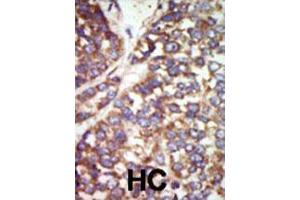 Image no. 2 for anti-P21-Activated Kinase 2 (PAK2) (AA 192-222), (N-Term) antibody (ABIN392433)