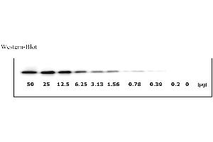 Image no. 4 for Epidermal Growth Factor Receptor (EGFR) ELISA Kit (ABIN625234)