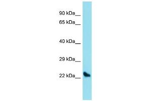 Image no. 1 for anti-Sclerostin Domain Containing 1 (SOSTDC1) (C-Term) antibody (ABIN2789781)